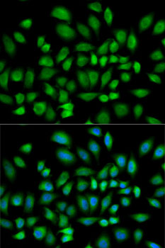 Anti-PDE4D Antibody (CAB13937)