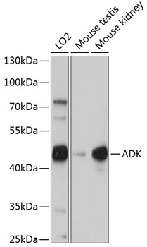 Anti-ADK Antibody (CAB15024)