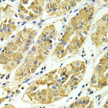 Anti-ARHGAP25 Antibody (CAB1223)