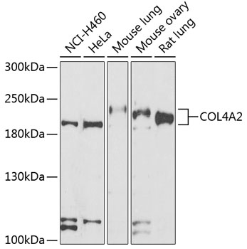 Anti-COL4A2 Antibody (CAB7657)