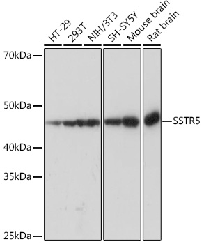 Anti-SSTR5 Antibody (CAB8698)