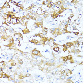 Anti-SERPINA3 Antibody (CAB2803)