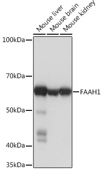 Anti-FAAH1 Antibody (CAB4099)