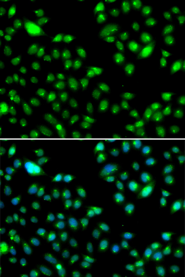 Anti-L3MBTL3 Antibody [KO Validated] (CAB7289)