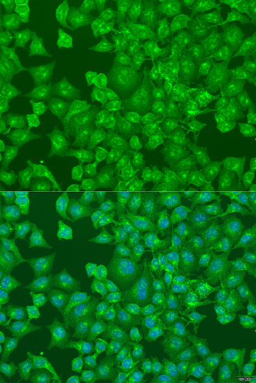 Anti-DCP2 Polyclonal Antibody (CAB8282)