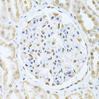 Anti-CBFB Antibody (CAB5305)