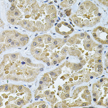 Anti-GALNT2 Antibody (CAB6910)