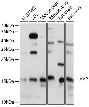 Anti-AVP Antibody (CAB1725)