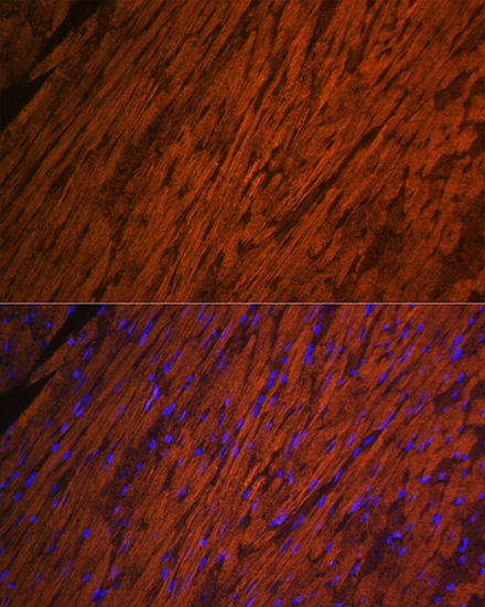 Anti-MYL2 Antibody (CAB5473)