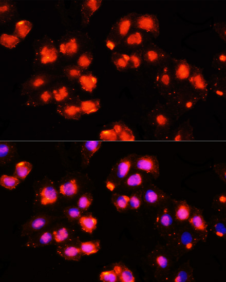 Anti-HOXB9 Antibody (CAB10222)