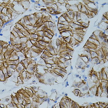 Anti-CLDN3 Antibody (CAB2946)