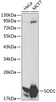 Anti-SOD1 Antibody (CAB0274)