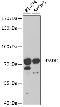 Anti-PADI4 Antibody (CAB1906)