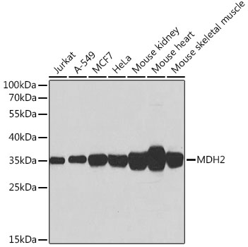 Anti-MDH2 Antibody (CAB6297)