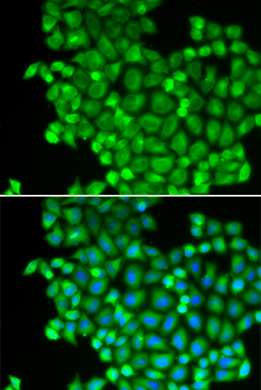 Anti-LDHA Antibody (CAB1146)