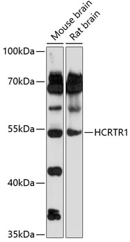 Anti-HCRTR1 Antibody (CAB14740)