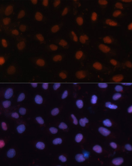 Anti-RB Antibody (CAB16966)