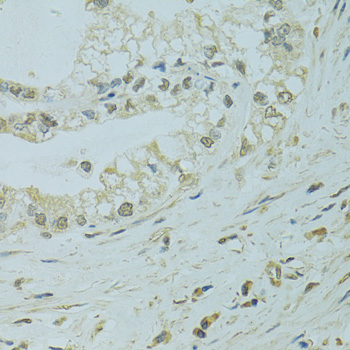 Anti-XBP1 Antibody (CAB14860)