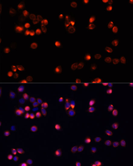 Anti-AKT2 Antibody (CAB0336)