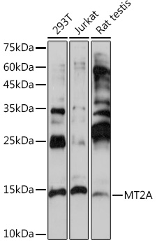 Anti-MT2A Antibody (CAB2018)