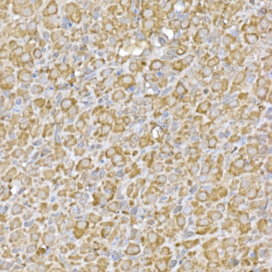 Immunohistochemistry of paraffin-embedded rat ovary using CASTOR1 Rabbit pAb at dilution of 1:50 (40x lens). Perform high pressure antigen retrieval with 10 mM citrate buffer pH 6. 0 before commencing with IHC staining protocol.