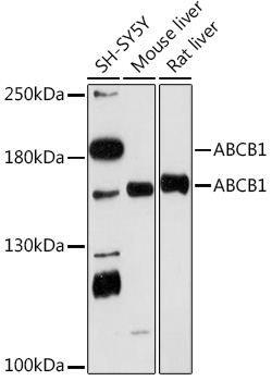 Anti-ABCB1 Antibody (CAB18684)