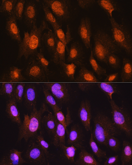 Anti-DDIT3 / CHOP Antibody (CAB6504)