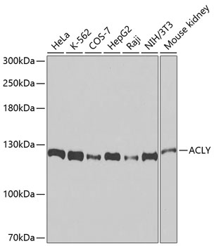 Anti-ACLY Monoclonal Antibody (CAB9901)