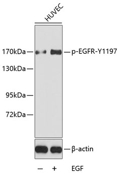 Anti-Phospho-EGFR-Y1197 Antibody (CABP0223)