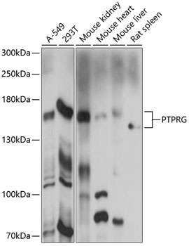 Anti-PTPRG Antibody (CAB14253)