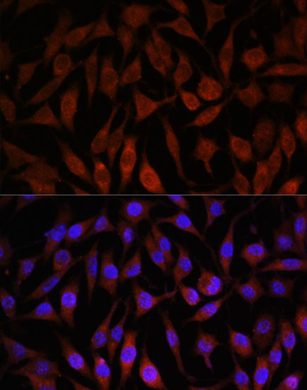 Anti-NEDD4L Polyclonal Antibody (CAB8085)