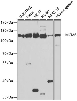 Anti-MCM6 Antibody (CAB1955)