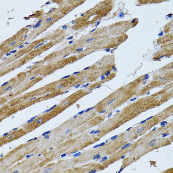 Anti-ATP5B Antibody (CAB5769)