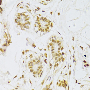 Anti-SNRPA Antibody (CAB6410)