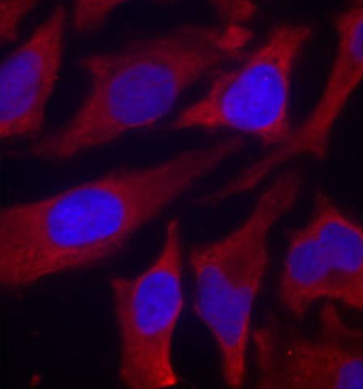 Anti-Phospho-Synapsin-1-S9 Antibody (CABP0244)