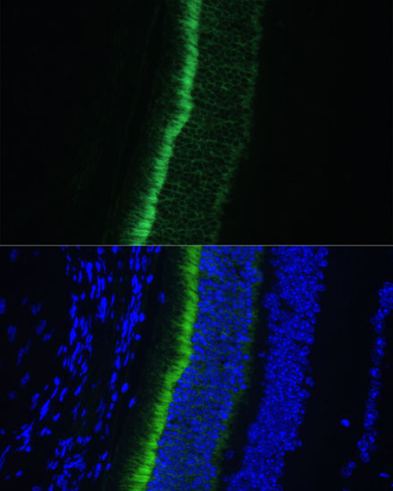 Anti-GNGT1 Antibody (CAB15675)