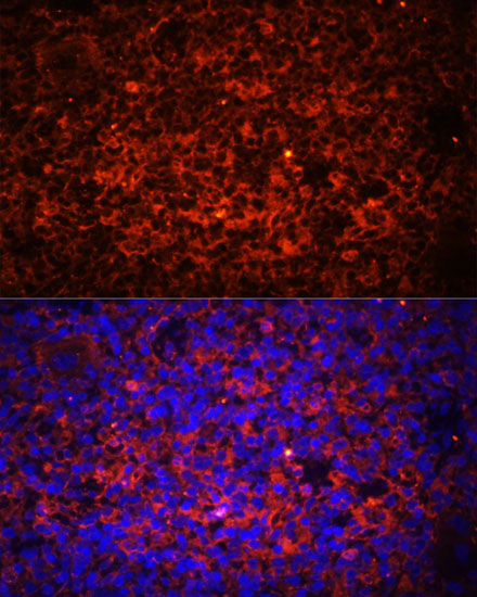 Anti-TLR8 Antibody (CAB1489)