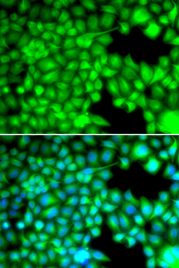 Anti-FABP3 Antibody (CAB5312)