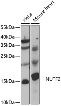 Anti-NUTF2 Antibody (CAB7057)