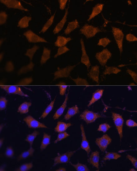 Anti-SERPINB9 Antibody (CAB6393)