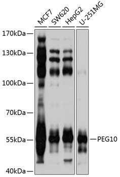 Anti-PEG10 Antibody (CAB2787)