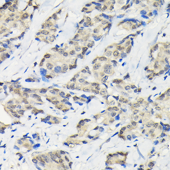 Anti-SSNA1 Antibody (CAB13377)