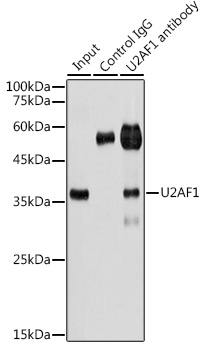 Anti-U2AF1 Antibody (CAB13166)