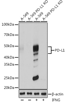 Anti-PD-L1 Antibody [KO Validated] (CAB19135)