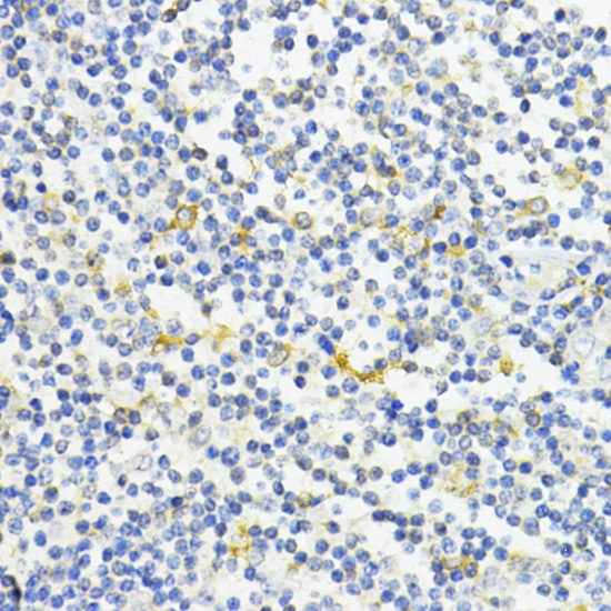 Anti-AMPKAlpha1 Antibody (CAB16960)