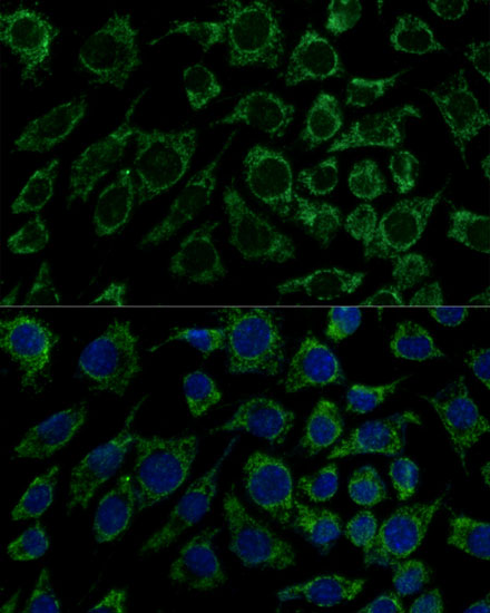 Anti-IDH3B Antibody (CAB13742)