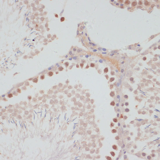 Anti-Cyclin G1 Antibody (CAB5292)