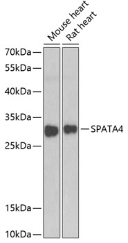 Anti-SPATA4 Antibody (CAB7608)