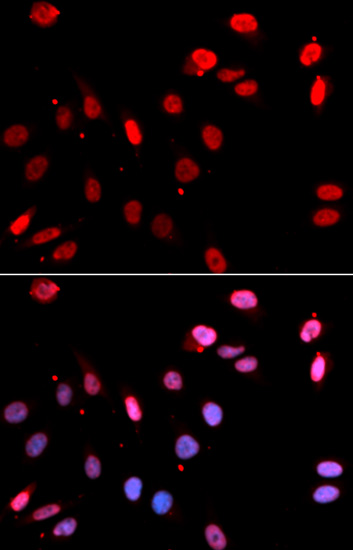 Anti-Rad18 Antibody (CAB13434)