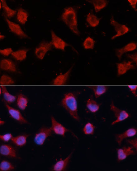 Anti-Caspase-8 Antibody (CAB11324)